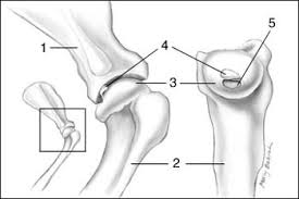 Osteochindrosis. What is it and what treatment is available.